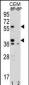 MNDA Antibody (N-term)